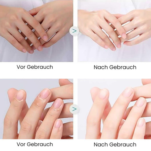 CareClip - Sichere, schmerzfreie Nagelpflege – mit nur einem Klick