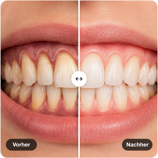 Zahnfleischvital Pro - Zahnfleisch wieder aufbauen in nur 10 Minuten pro Tag
