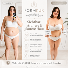 Lade das Bild in den Galerie-Viewer, Formkur - Anti-Cellulite Massagegerät für Bauch, Beine &amp; Po