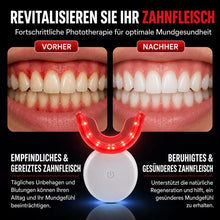 Lade das Bild in den Galerie-Viewer, Zahnfleischvital Pro - Zahnfleisch wieder aufbauen in nur 10 Minuten pro Tag