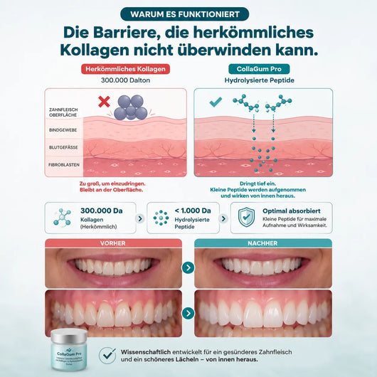 CollaGum Pro – Intensive Zahnfleischpflege mit Kollagen & Hydroxylapatit
