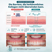 Lade das Bild in den Galerie-Viewer, CollaGum Pro – Intensive Zahnfleischpflege mit Kollagen &amp; Hydroxylapatit
