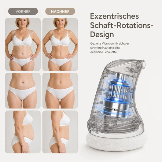 Formkur - Anti-Cellulite Massagegerät für Bauch, Beine & Po